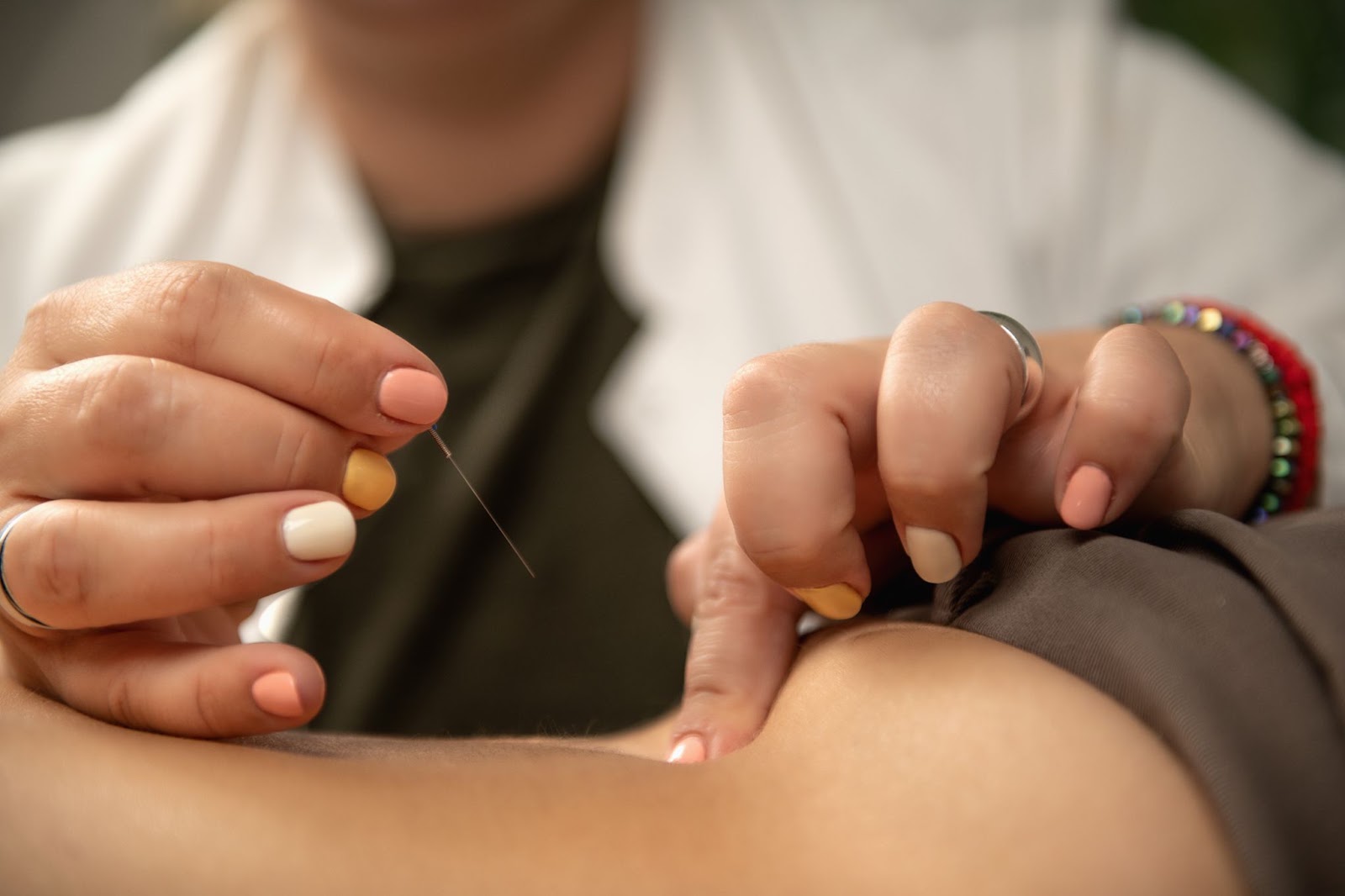 Manhattan acupuncture services
