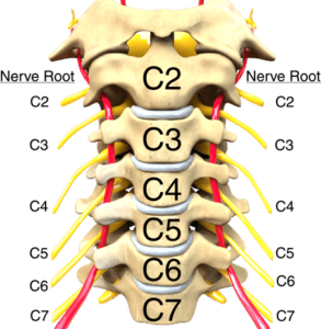neck pain