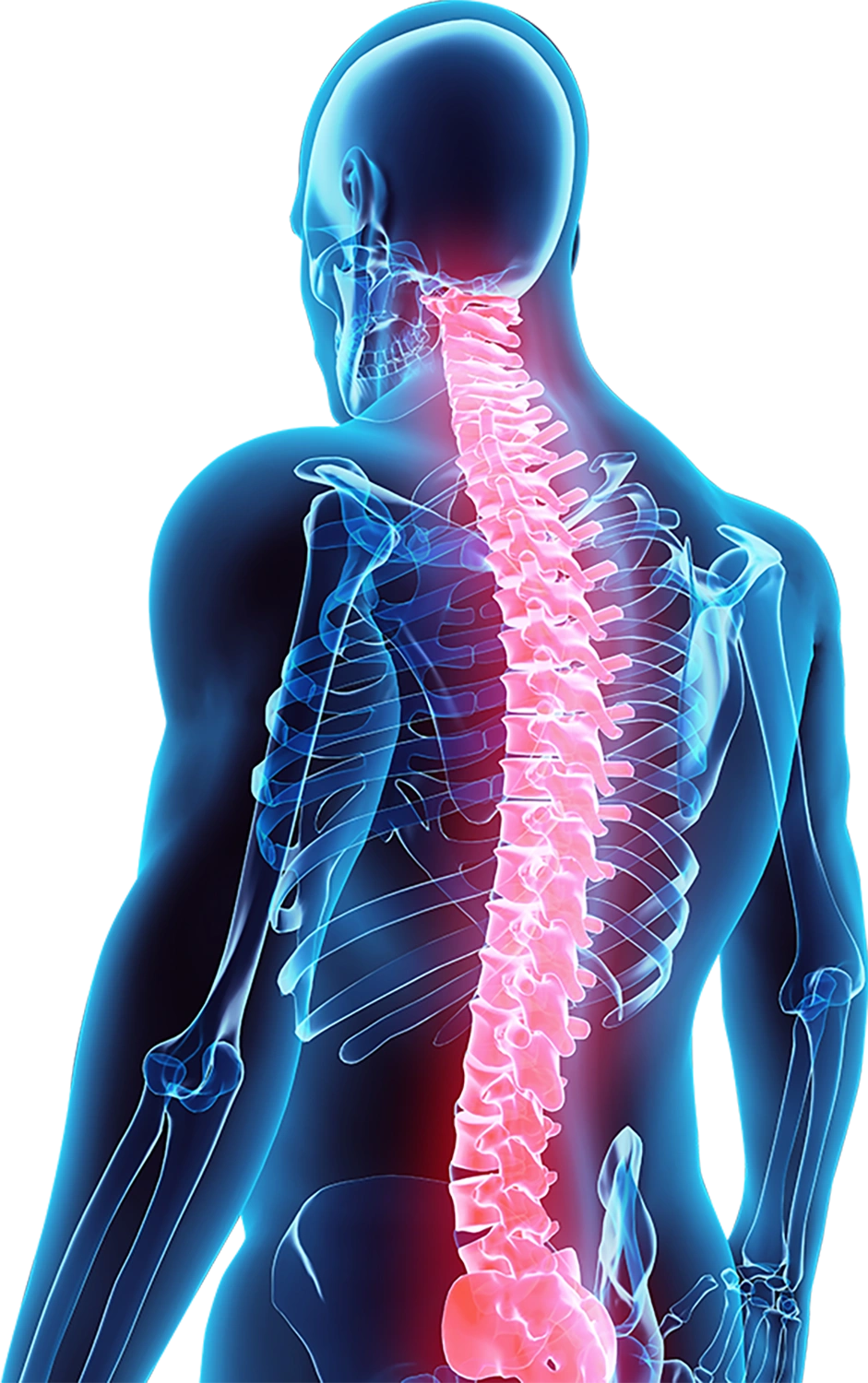 3D illustration highlighting common spine and back pain areas: head/neck, upper back, shoulder/clavicle, mid-back, lower back, and the elbows, hands, and wrists.