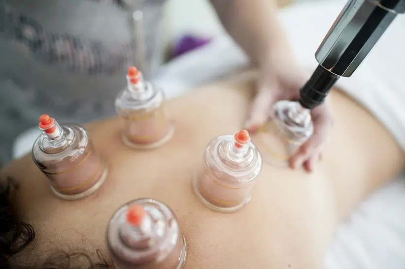Cupping therapy is not suitable for everyone. It should be avoided if you have any of the following conditions