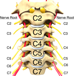neck pain